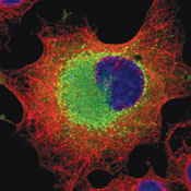 Adrenal Cancer Survival Rate Adrenal Cancer Survival Rate