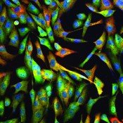 Esophageal Cancer Treatment